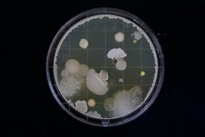 bacteria samples