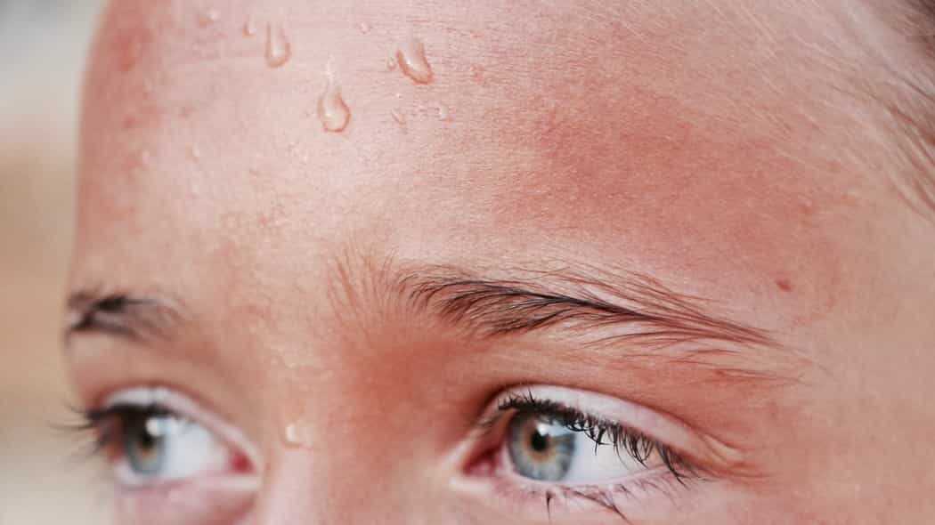 sweaty forehead